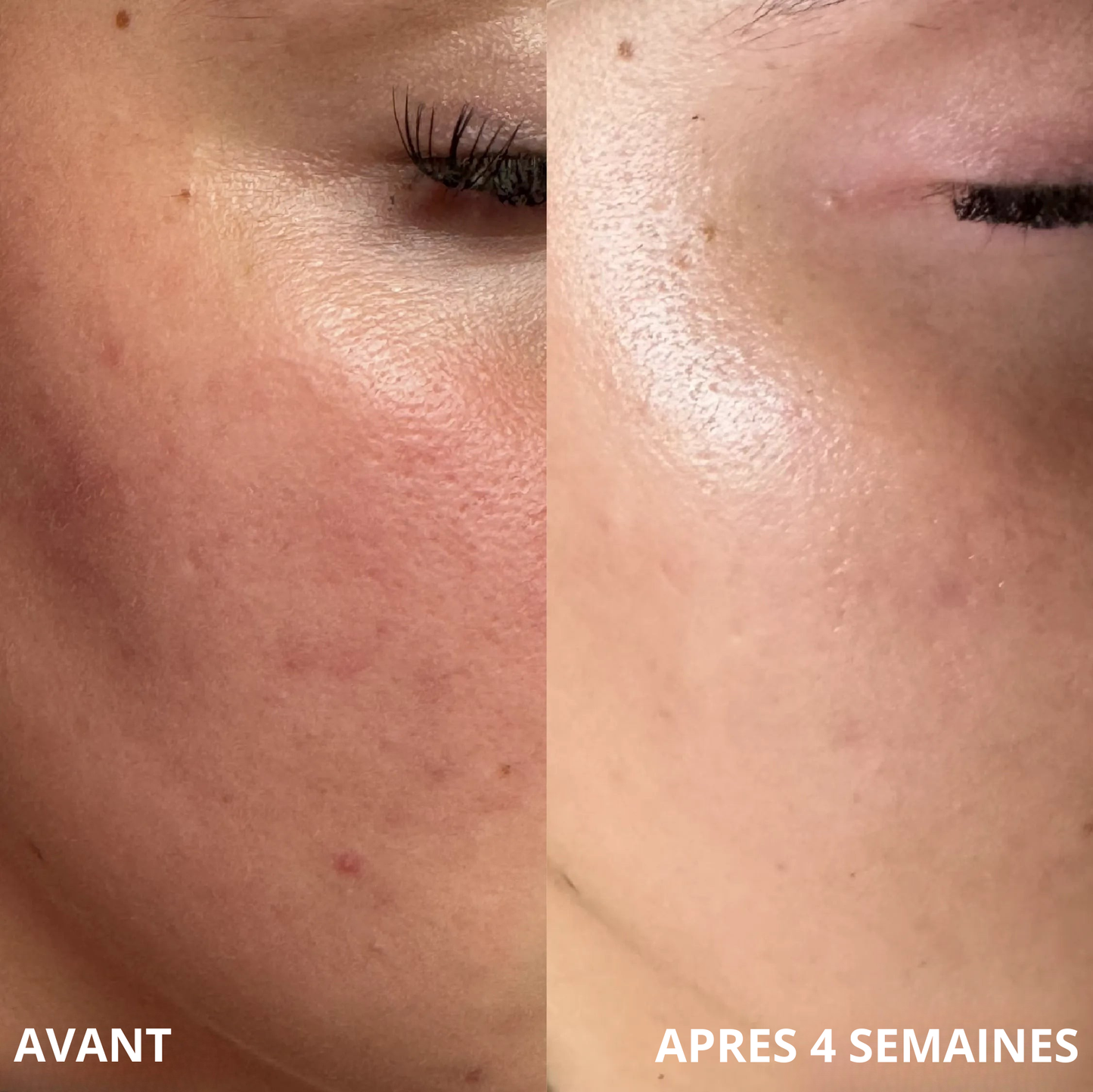 Masque Bio Collagène